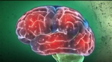 医疗器材机器探索人类记忆医疗题材大脑研究